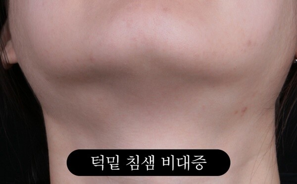 사진=분당 로즈피부과 배지영 원장