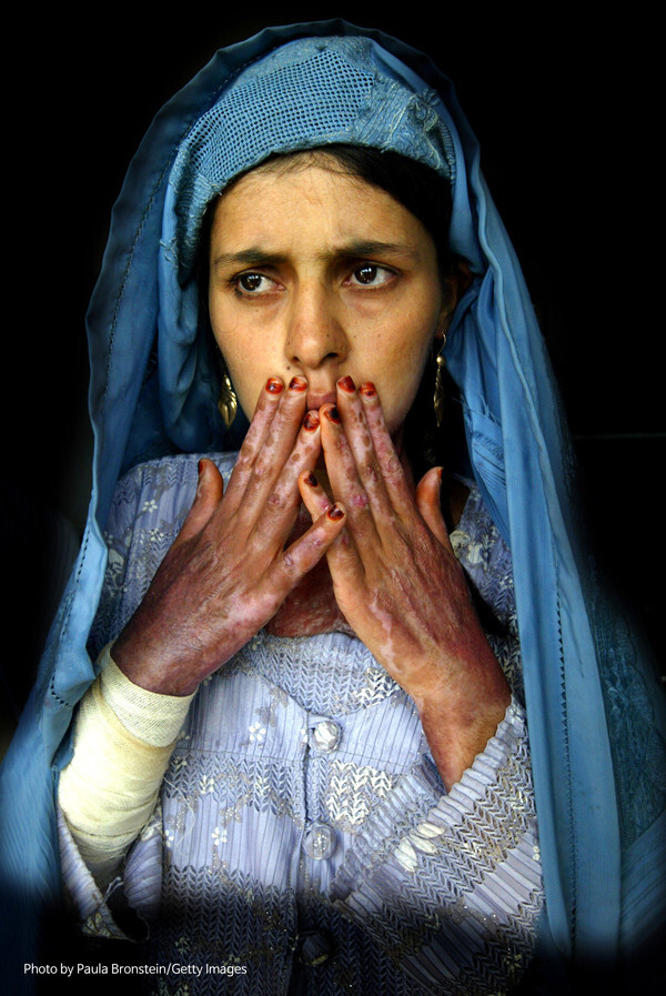 사진: 절박함으로 분신자살을 시도한 헤라트 여성 2004.10.22 ⓒPhoto by Paula Bronstein [제공 = 게티이미지]